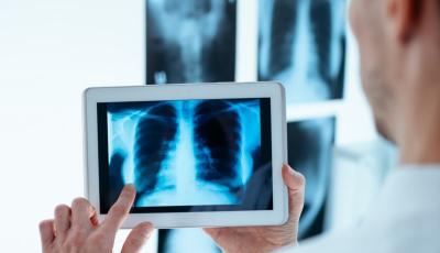 Provider using digital x-ray 